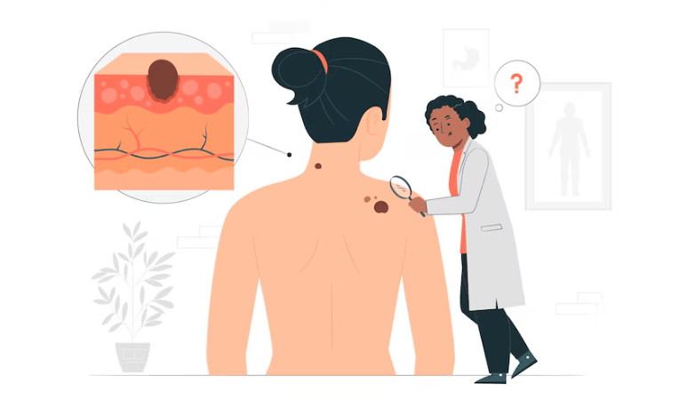 लिपोमा होने का कारण, लिपोमा का आयुर्वेदिक इलाज, Lipoma Hone Ka Karan, Lipoma Ka Ayurvedic Ilaj