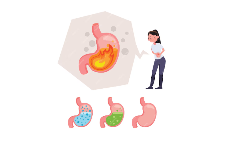 पेट में गैस के लक्षण, Pet Mein Gas Ke Lakshan,